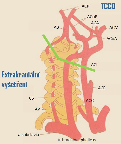 Rozsah neurosonologického vyšetření