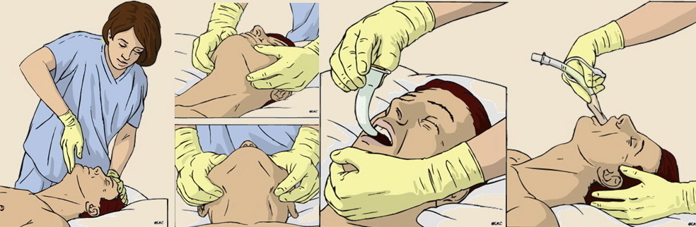 ERC guidelines 2010
