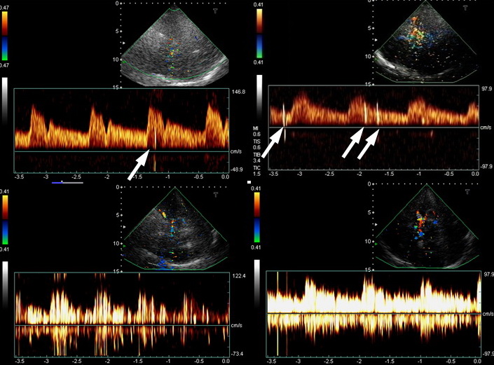 TCCD bubble test